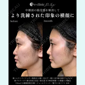 eクリニック 大阪院 八木 良太医師の症例