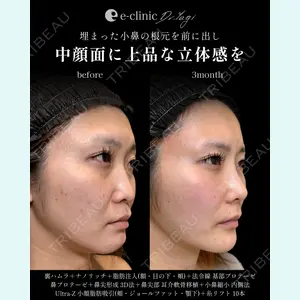 eクリニック 大阪院 八木 良太医師の症例