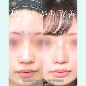 eクリニック 福岡院 伊藤 渉医師の症例