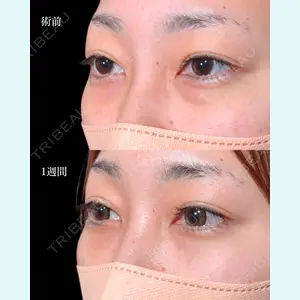 東京シンデレラ美容外科 大宮院 竹田 昌平医師の症例