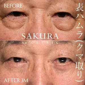 サクラアズクリニック 心斎橋院 佐藤 博文医師の症例