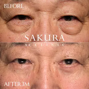 サクラアズクリニック 心斎橋院 佐藤 博文医師の症例