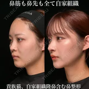 Zetith Beauty Clinic 銀座院 鉄 鑠医師の症例