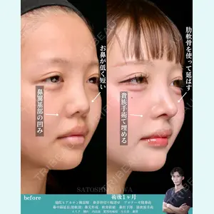 Zetith Beauty Clinic 銀座院 小川 悟史医師の症例