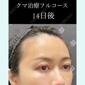 EMMO FACE CLINIC 大宮院 廣松 直樹医師の症例