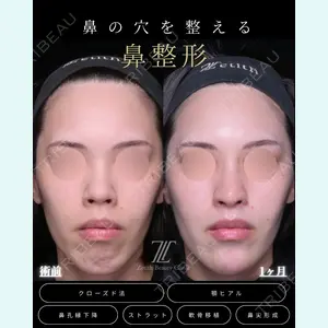 Zetith Beauty Clinic 福岡院 羽根 和秀医師の症例