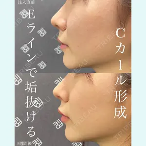 EMMO FACE CLINIC 大宮院 廣松 直樹医師の症例