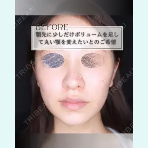 小倉美容外科/美容皮膚科 ビラビューティークリニック 大村 亞蘭医師の症例