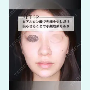 小倉美容外科/美容皮膚科 ビラビューティークリニック 大村 亞蘭医師の症例