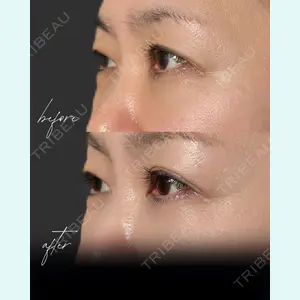 小倉美容外科/美容皮膚科 ビラビューティークリニック 大村 亞蘭医師の症例