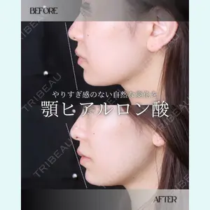 小倉美容外科/美容皮膚科 ビラビューティークリニック 大村 亞蘭医師の症例