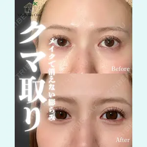 小倉美容外科/美容皮膚科 ビラビューティークリニック 大村 亞蘭医師の症例