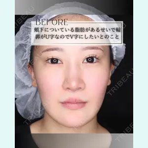 小倉美容外科/美容皮膚科 ビラビューティークリニック 大村 亞蘭医師の症例