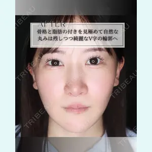 小倉美容外科/美容皮膚科 ビラビューティークリニック 大村 亞蘭医師の症例