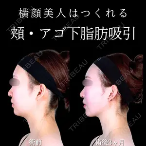 アリエル美容クリニック 水戸院 天白 典秀医師の症例