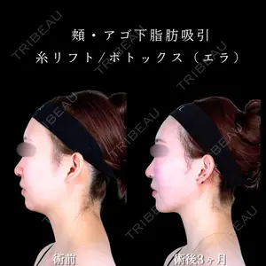 アリエル美容クリニック 水戸院 天白 典秀医師の症例