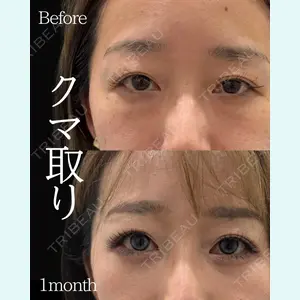 ネビュラクリニック 東京錦糸町院 岩切 琢磨医師の症例