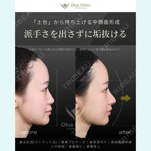 Otus Clinic 【オータスクリニック】 中 徳太郎医師の症例