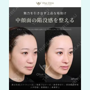 Otus Clinic 【オータスクリニック】 中 徳太郎医師の症例