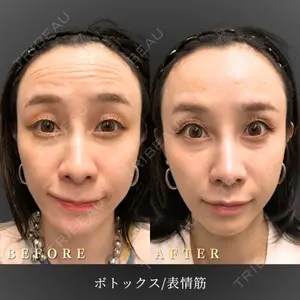 BiBiクリニック 山本 幸一郎医師の症例