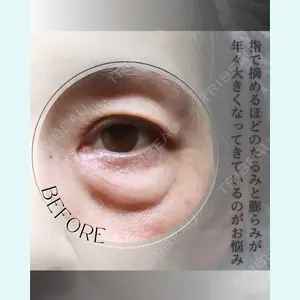 小倉美容外科/美容皮膚科 ビラビューティークリニック 大村 亞蘭医師の症例