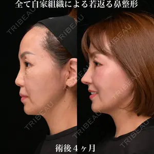 Zetith Beauty Clinic 銀座院 鉄 鑠医師の症例