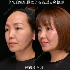 Zetith Beauty Clinic 銀座院 鉄 鑠医師の症例