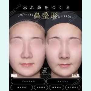 Zetith Beauty Clinic 福岡院 羽根 和秀医師の症例