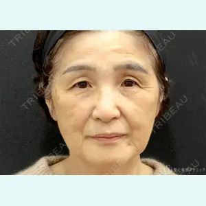 聖心美容クリニック 福岡院 美原 寿之医師の症例