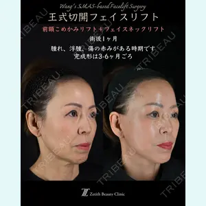 Zetith Beauty Clinic 新宿院 副島直人医師の症例