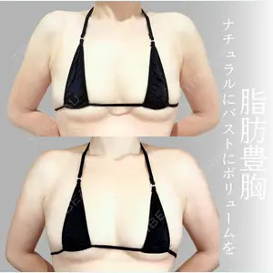 アリエル美容クリニック 横浜院 加藤 敏次医師の症例