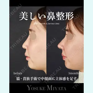 シンデレラ＆ダヴィンチクリニック 宮田 洋佑医師の症例