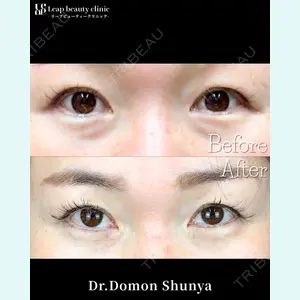 Leap beauty clinic 土門 駿也医師の症例