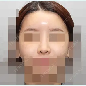 加美（GAMI）整形外科 パク・ゴヌク医師の症例