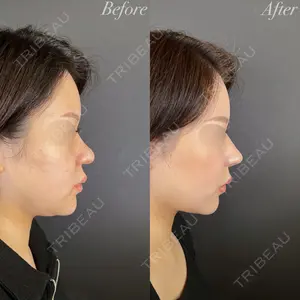 R Beauty CLINIC 大阪院 小池 泰弘医師の症例