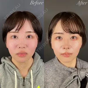R Beauty CLINIC 大阪院 小池 泰弘医師の症例