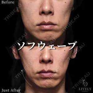 ライブリークリニック 大阪院の症例