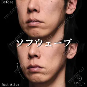 ライブリークリニック 大阪院の症例