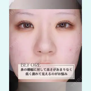 小倉美容外科/美容皮膚科 ビラビューティークリニック 大村 亞蘭医師の症例