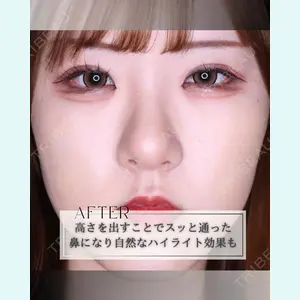 小倉美容外科/美容皮膚科 ビラビューティークリニック 大村 亞蘭医師の症例