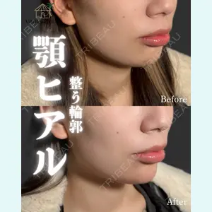 小倉美容外科/美容皮膚科 ビラビューティークリニック 大村 亞蘭医師の症例