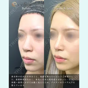 eクリニック 福岡院 伊藤 渉医師の症例