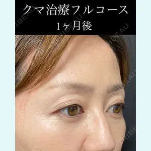 EMMO FACE CLINIC 大宮院 廣松 直樹医師の症例