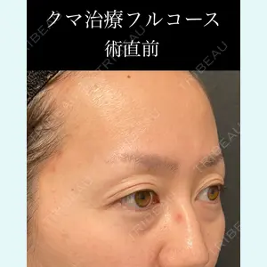 EMMO FACE CLINIC 大宮院 廣松 直樹医師の症例