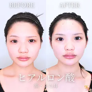 SK新宿歌舞伎町美容外科・歯科の症例