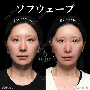 ライブリークリニック 大阪院の症例