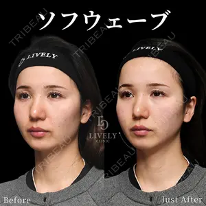 ライブリークリニック 大阪院の症例