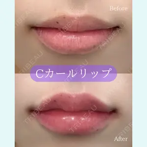 ルラ美容クリニック 郡山院 横瀬 晃平医師の症例