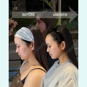 HAAB BEAUTY CLINIC 南青山本院（新院） 金子 雄医師の症例