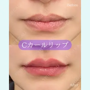 ルラ美容クリニック 郡山院の症例